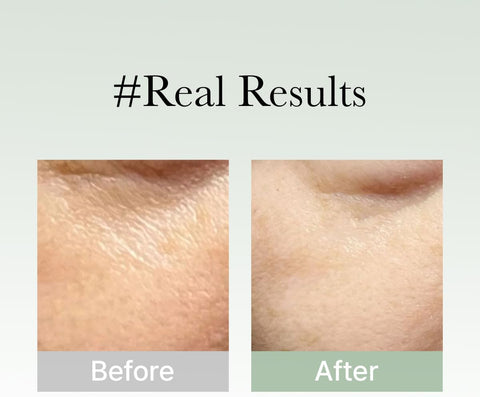 Arencia Holy Hyssop Serum 30 50G