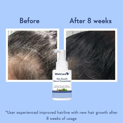 Wishcare Hair Growth Serum Concentrate - Redensyl, Anagain, Caffeine, Biotin, Keratin & Rice Water