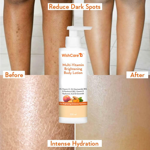 Wishcare Multi-Vitamin Brightening Body Lotion - 5% Vitamin C, 5% Niacinamide(B3), Panthenol(B5)