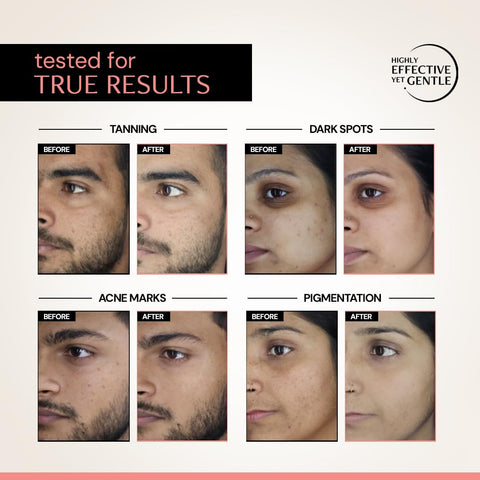 Deconstruct Clearing Serum - 5% Niacinamide & 2% Alpha Arbutin - 20ml