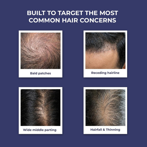 Conscious Chemist Full Strength Anti-Hairfall Shampoo - 200 ml