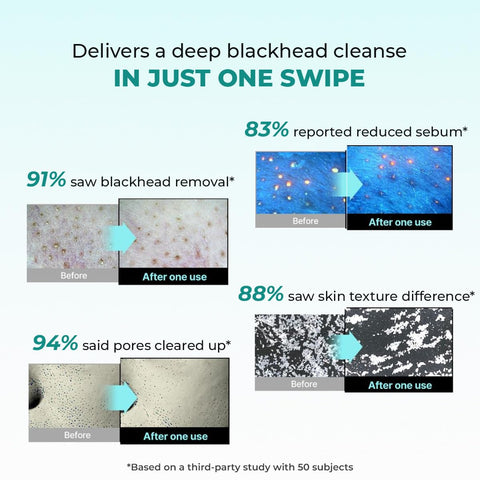 Conscious Chemist Blackhead melting water - 130 ml