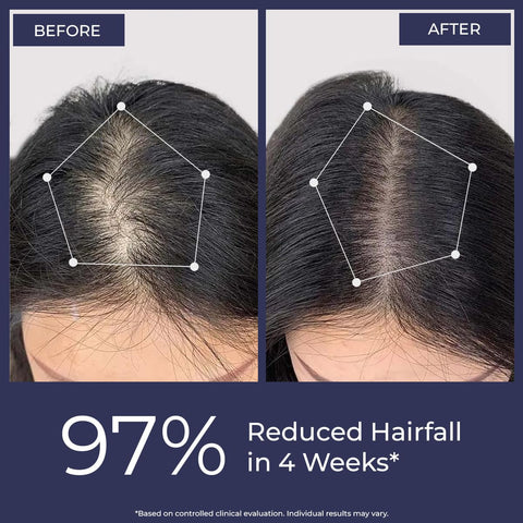 Conscious Chemist Full Strength Anti-Hairfall Post Wash Rosmeary Spray 200 ml