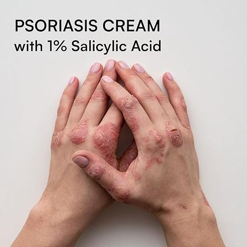 Brinton Psoramist Moisturizing Cream 150gm