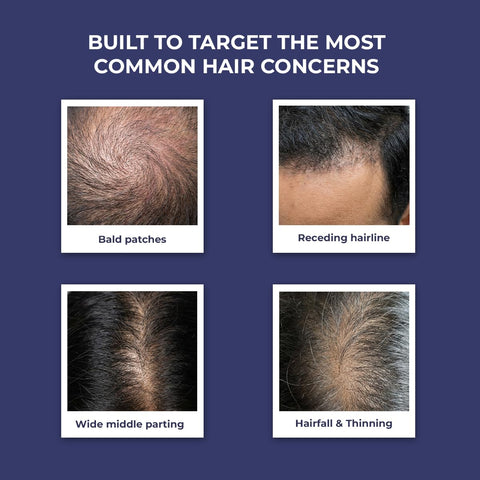 Conscious Chemist Full Strength Hair Growth Serum 30 ml