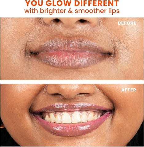 Foxtale Brightening Lip Balm With Peptides, Vitamin C & Hyaluronic Acid - Light Mauve Glaze